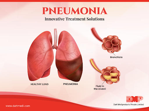 pneumonia