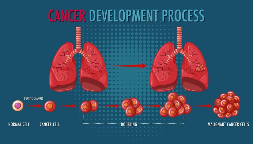 cancer development process,abnormal cell,cancer cell