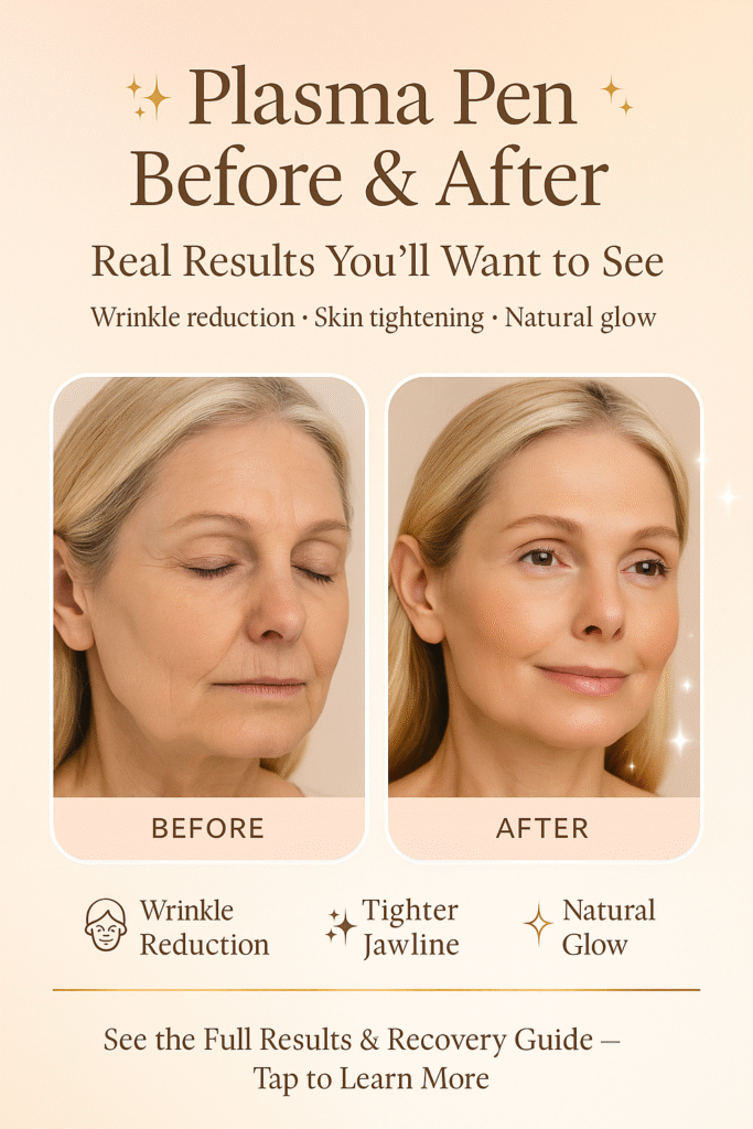 plasma pen treatment before and after result
wrinkle reduction
tighter jawline
natural glow
